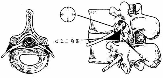 post image one